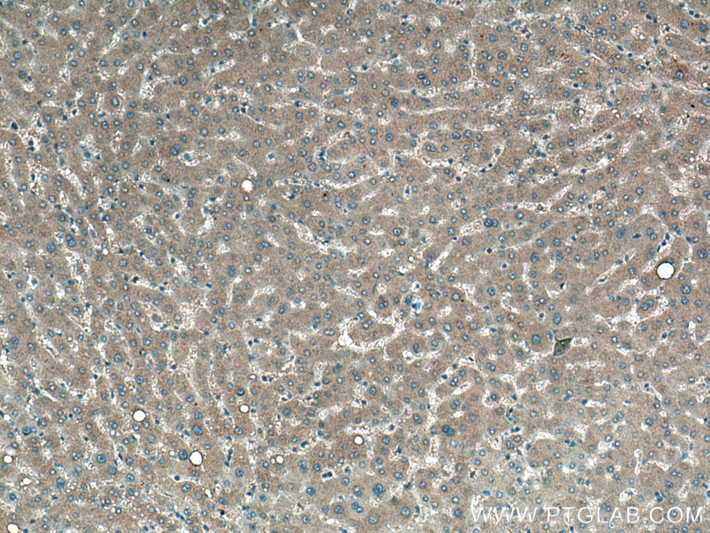 Immunohistochemistry (IHC) staining of human liver tissue using EPO Monoclonal antibody (66975-1-Ig)