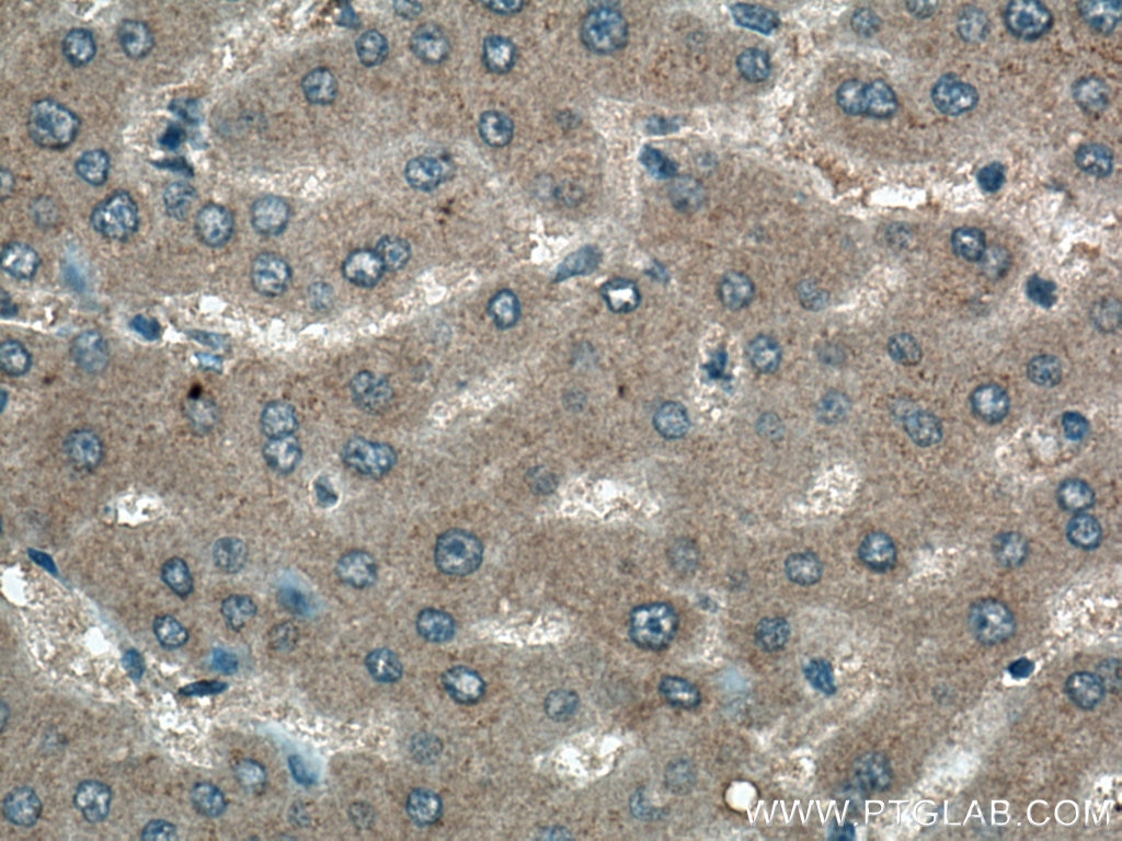 Immunohistochemistry (IHC) staining of human liver tissue using EPO Monoclonal antibody (66975-1-Ig)