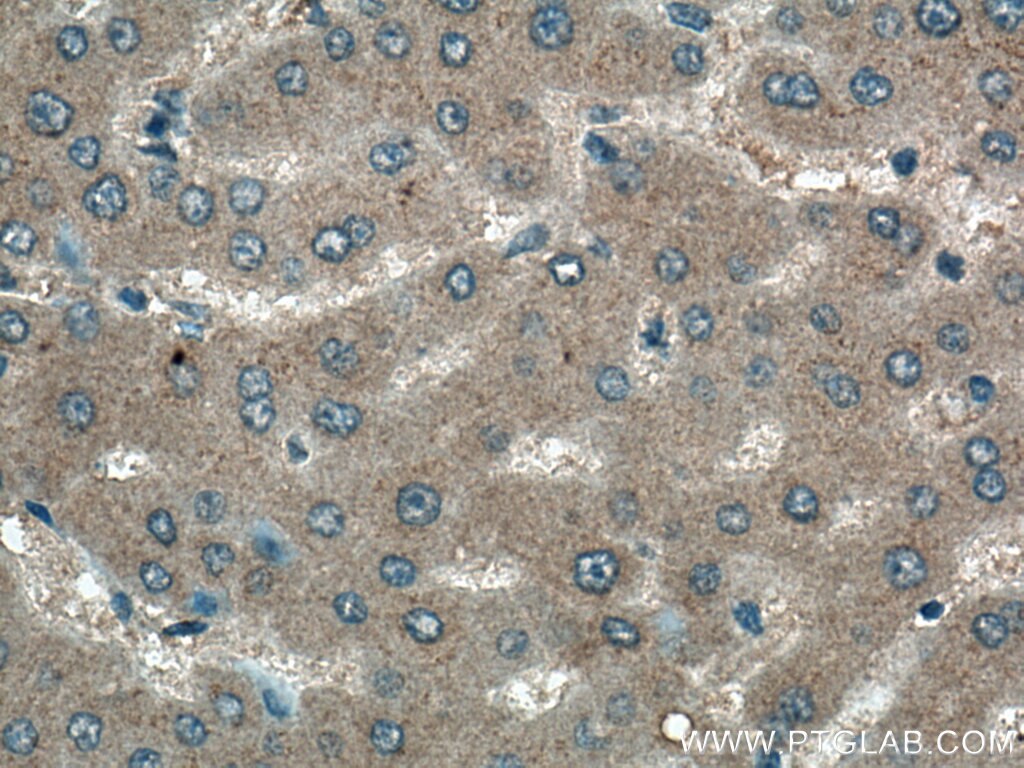 Immunohistochemistry (IHC) staining of human liver tissue using EPO Monoclonal antibody (66975-1-Ig)