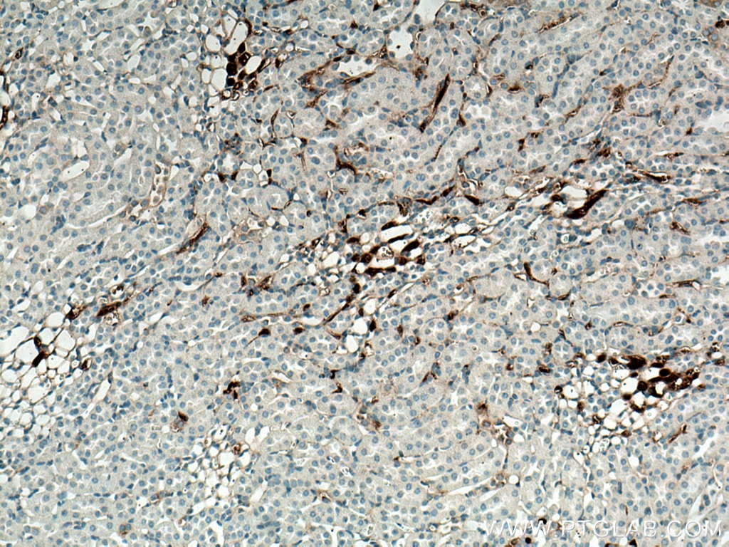 IHC staining of mouse kidney using 66975-1-Ig