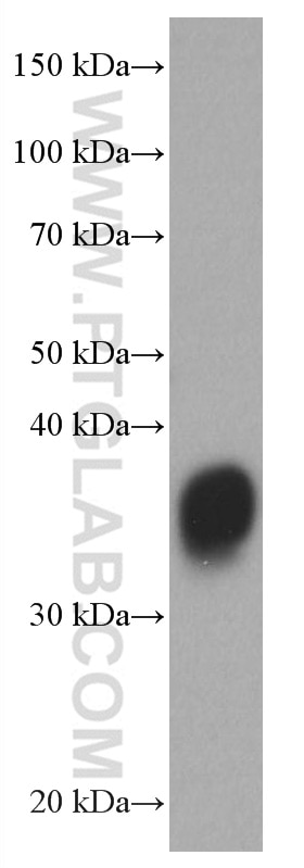 WB analysis of Recombinant protein using 66975-1-Ig