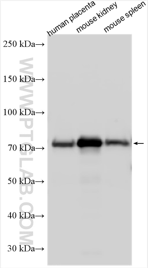 Western Blot (WB) analysis of various lysates using EPOR Polyclonal antibody (30766-1-AP)