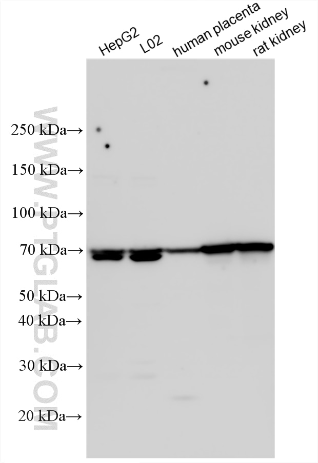 Western Blot (WB) analysis of various lysates using EPOR Polyclonal antibody (30766-1-AP)
