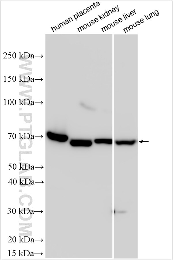 Western Blot (WB) analysis of various lysates using EPOR Polyclonal antibody (32537-1-AP)