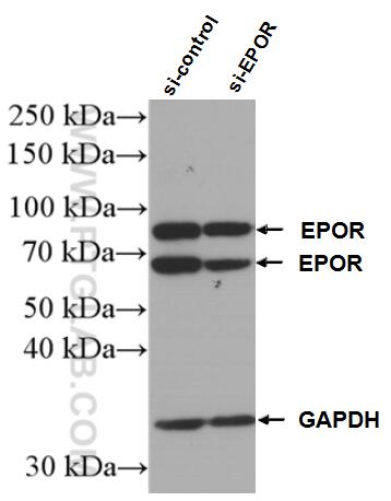 Western Blot (WB) analysis of Jurkat cells using EPOR Polyclonal antibody (55308-1-AP)