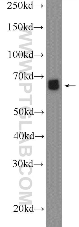 EPOR Polyclonal antibody
