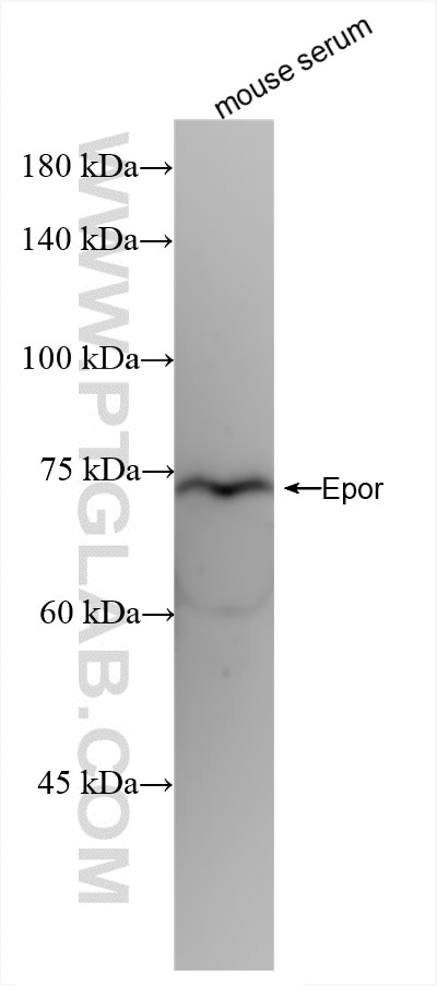 Western Blot (WB) analysis of various lysates using EPOR Recombinant antibody (85901-1-RR)