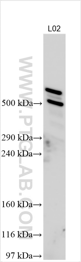 Western Blot (WB) analysis of various lysates using EPPK1 Polyclonal antibody (31475-1-AP)