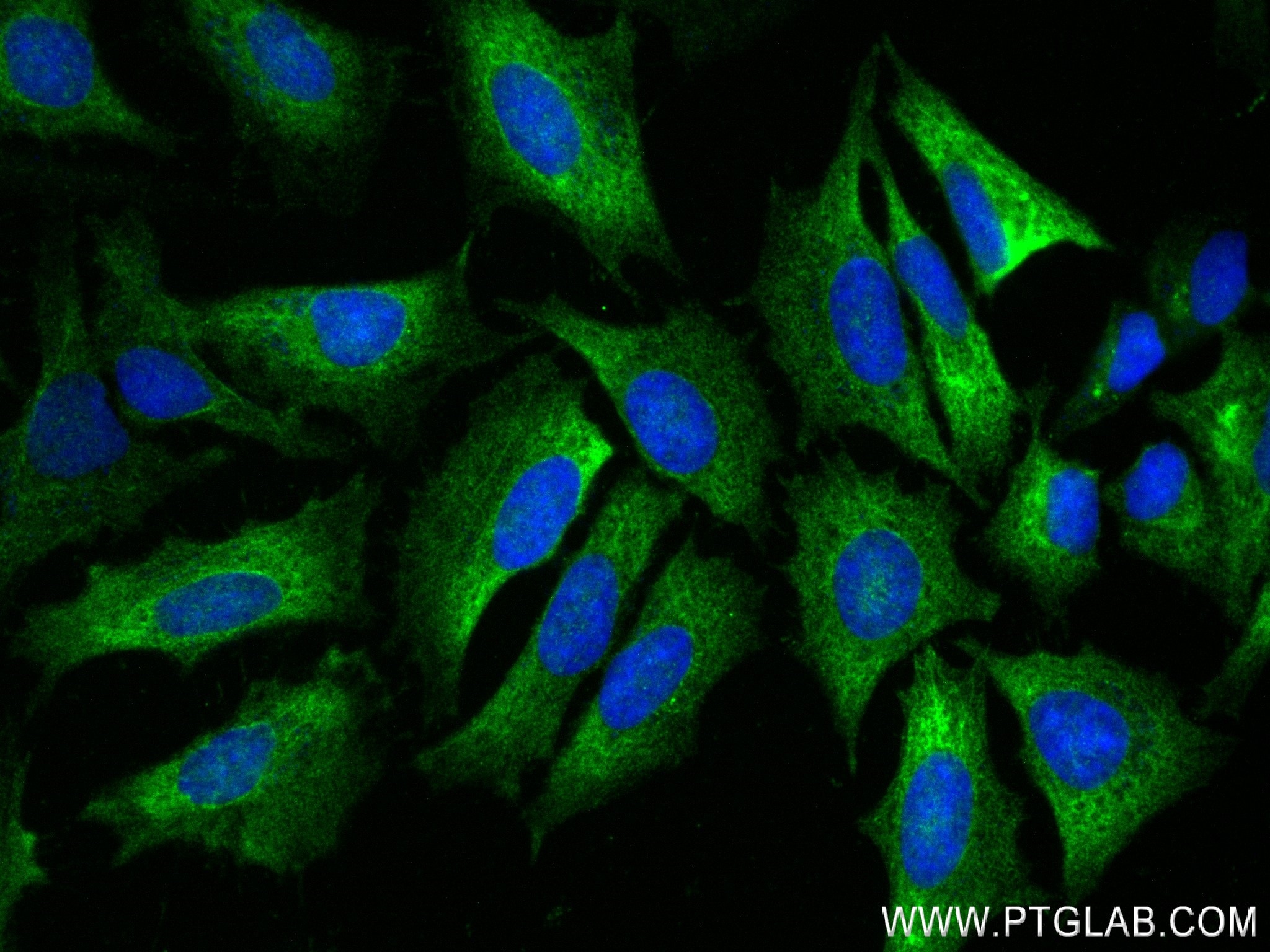 Immunofluorescence (IF) / fluorescent staining of HeLa cells using EPPK1 Recombinant antibody (84344-2-RR)