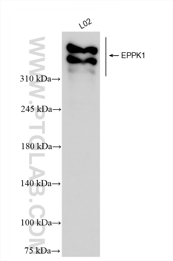 Western Blot (WB) analysis of L02 cells using EPPK1 Recombinant antibody (84344-2-RR)