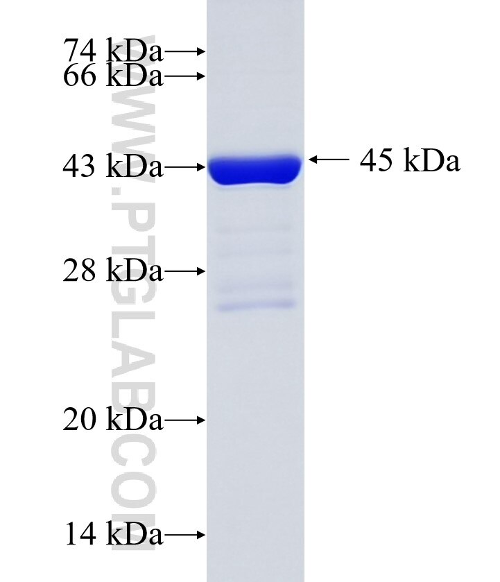 EPPK1 fusion protein Ag35749 SDS-PAGE