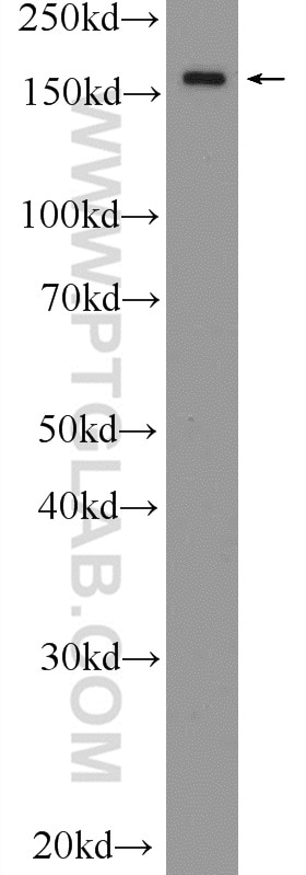 Western Blot (WB) analysis of HEK-293 cells using EPRS Polyclonal antibody (25307-1-AP)