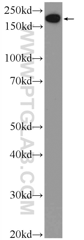 Western Blot (WB) analysis of Jurkat cells using EPRS Polyclonal antibody (25307-1-AP)