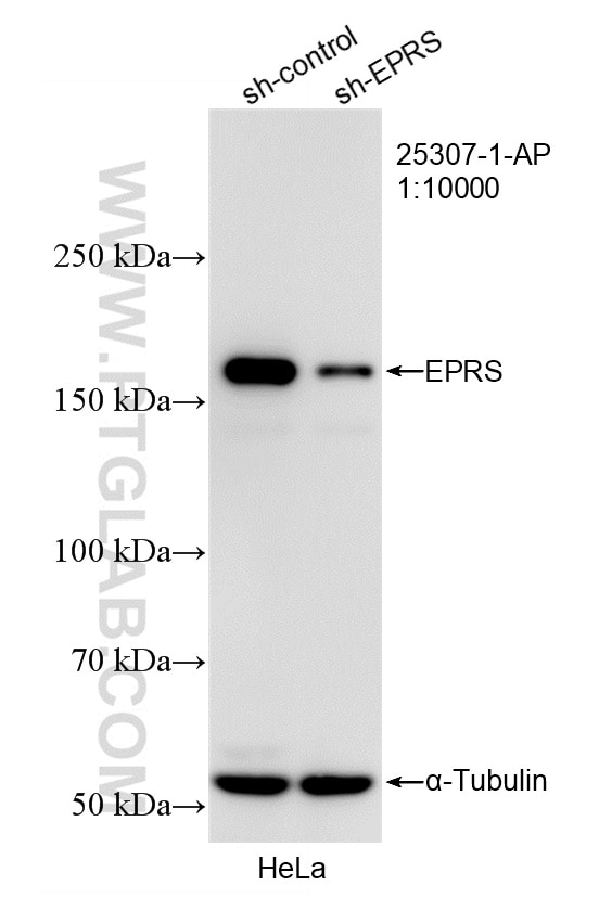 WB result of EPRS antibody (25307-1-AP; 1:10000; incubated at room temperature for 1.5 hours) with sh-Control and sh-EPRS transfected HeLa cells. Western Blot (WB) analysis of HeLa cells using EPRS Polyclonal antibody (25307-1-AP)
