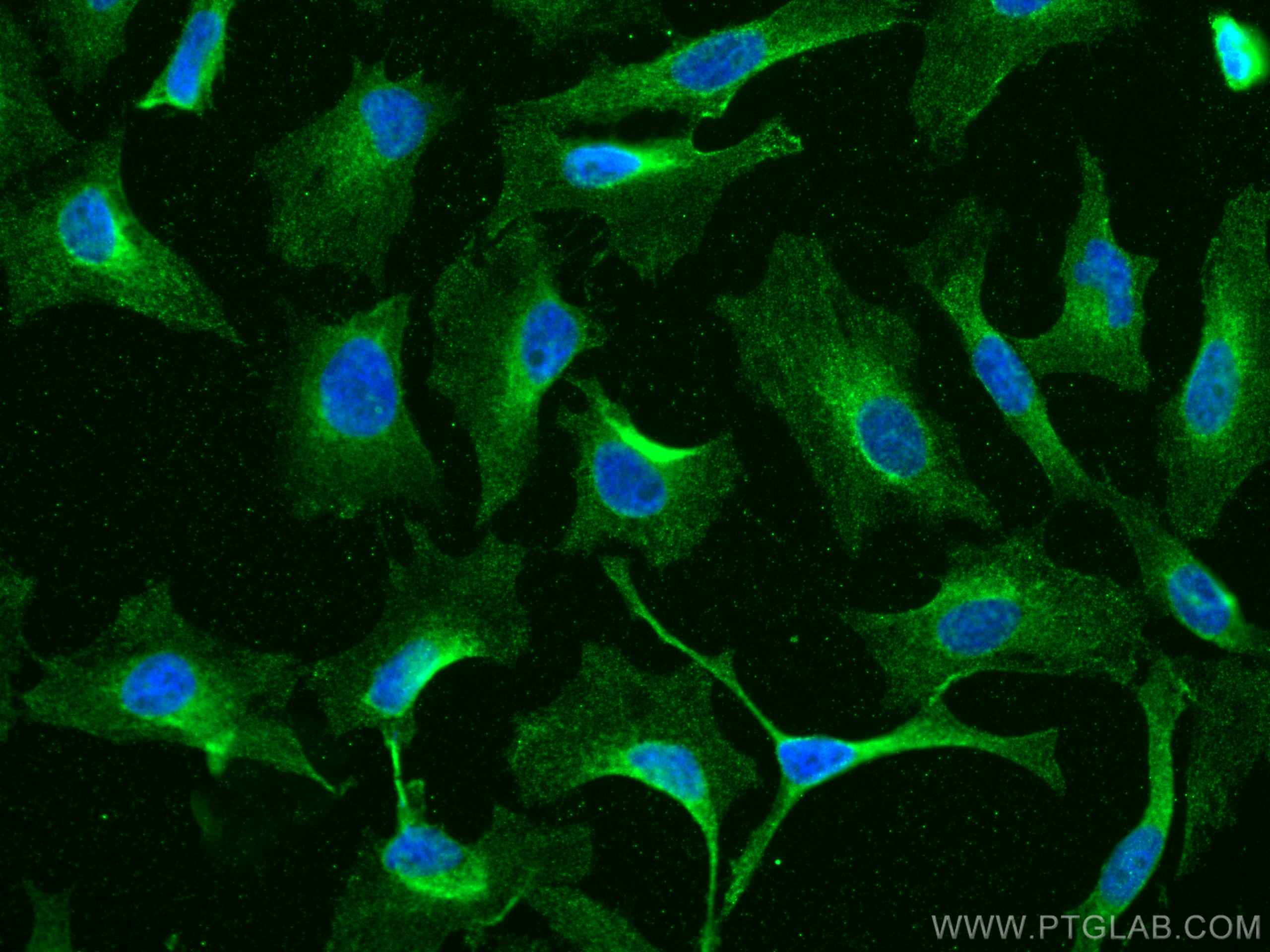 Immunofluorescence (IF) / fluorescent staining of HeLa cells using EPRS Monoclonal antibody (67712-1-Ig)