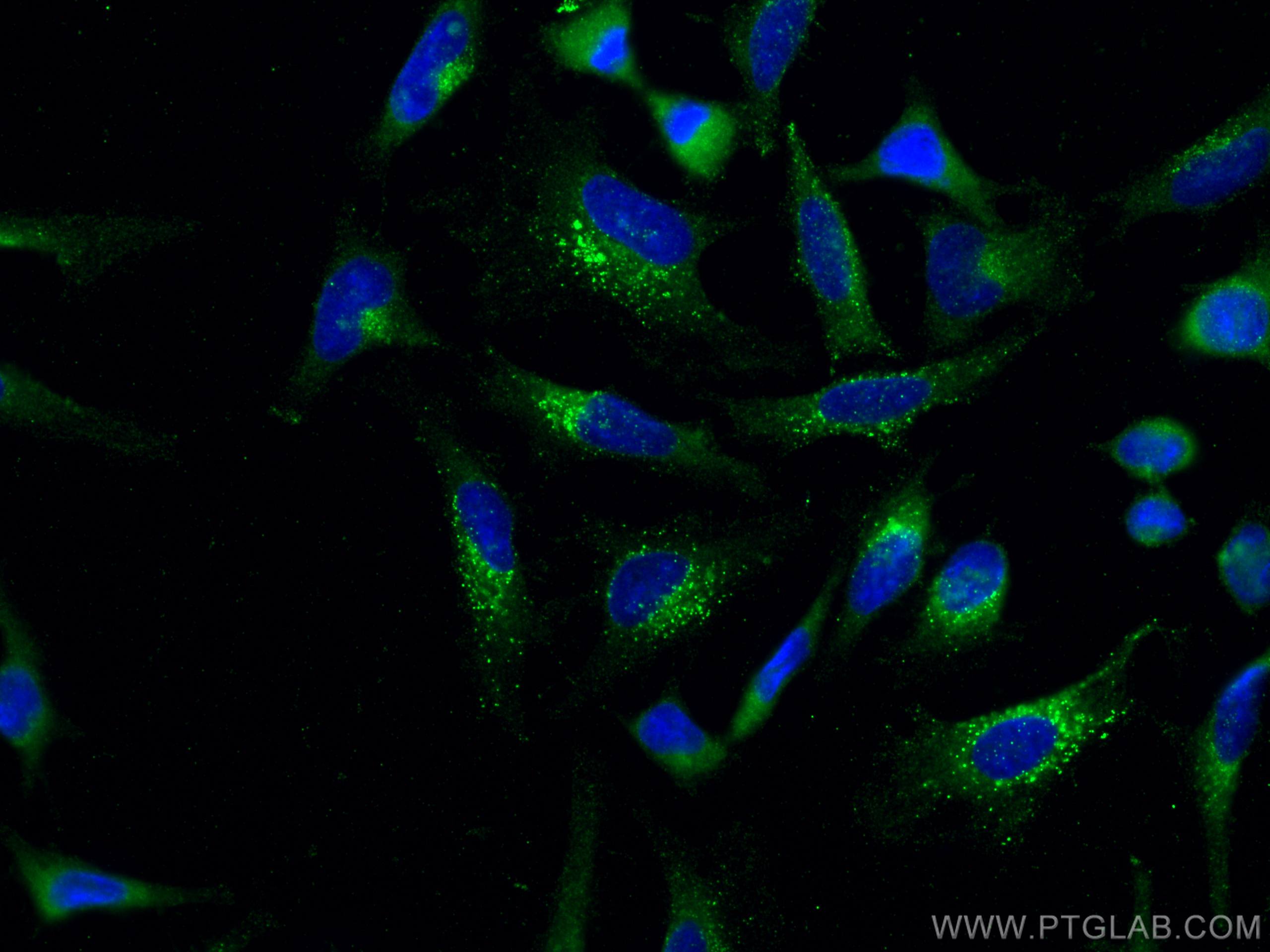 Immunofluorescence (IF) / fluorescent staining of HeLa cells using EPRS Monoclonal antibody (67712-1-Ig)