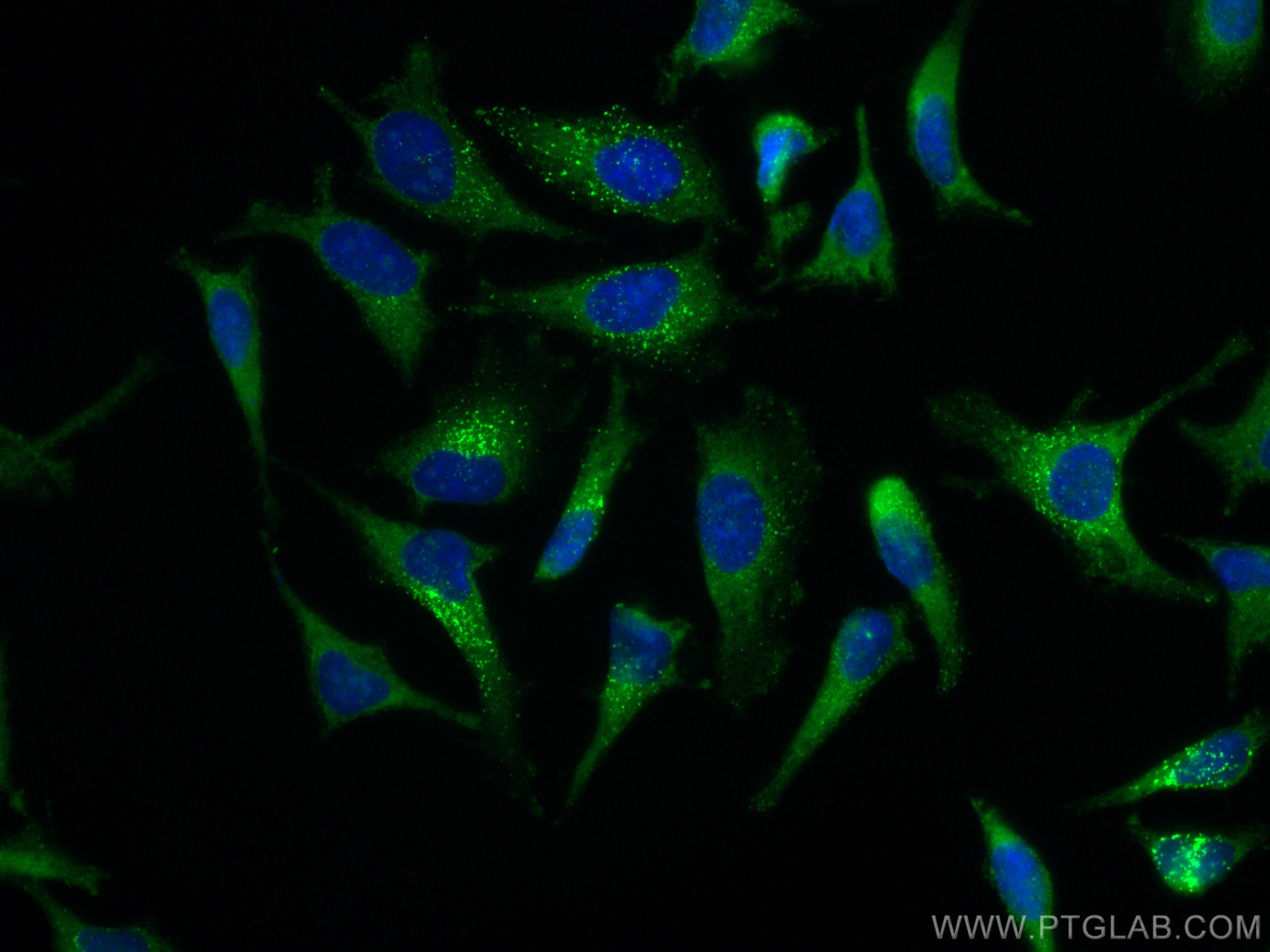 Immunofluorescence (IF) / fluorescent staining of HeLa cells using CoraLite® Plus 488-conjugated EPRS Monoclonal anti (CL488-67712)