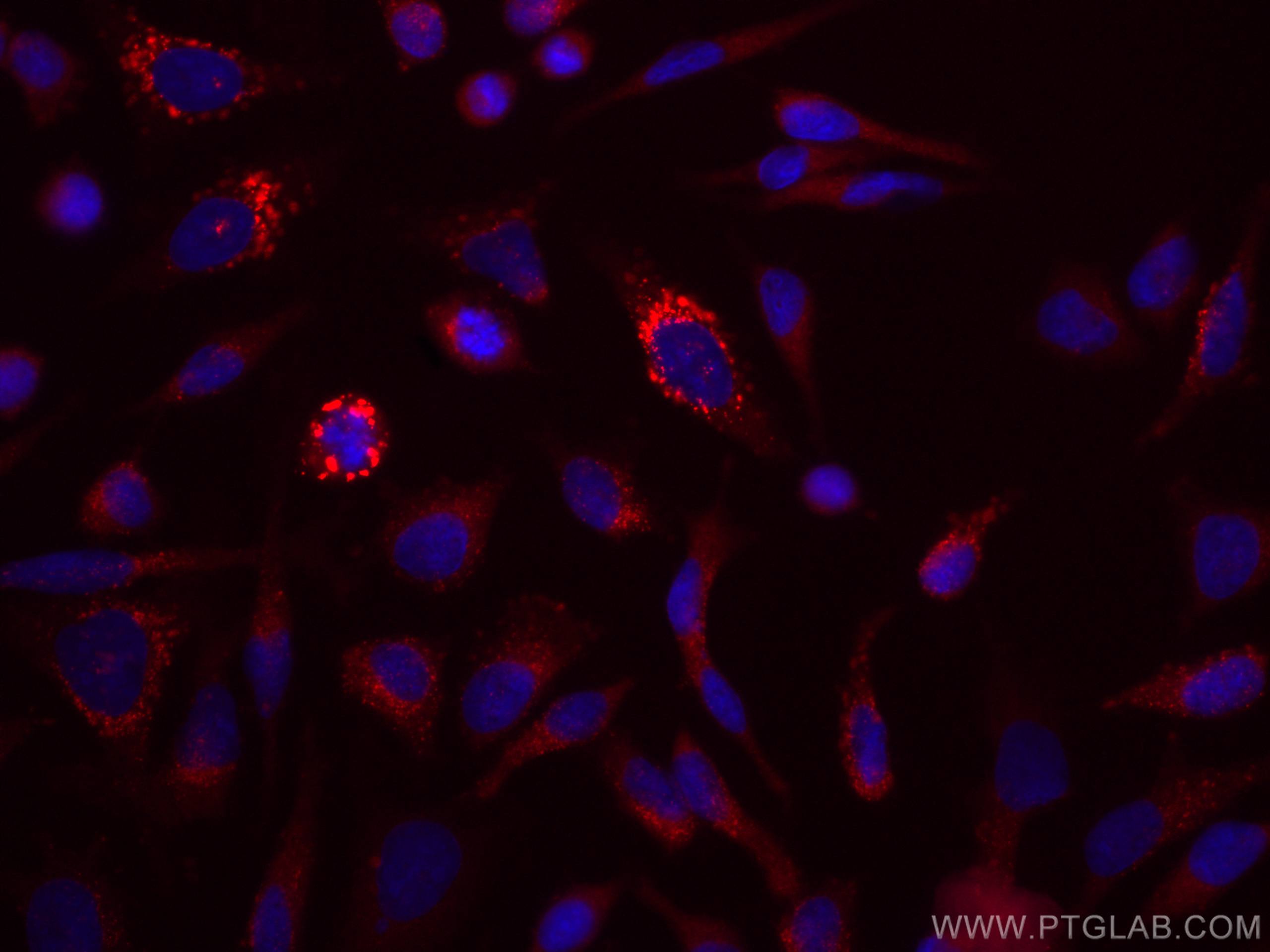 Immunofluorescence (IF) / fluorescent staining of HeLa cells using CoraLite® Plus 647-conjugated EPRS Monoclonal anti (CL647-67712)