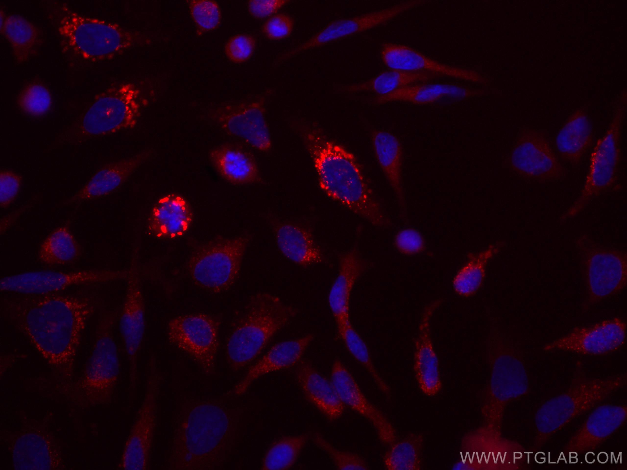 IF Staining of HeLa using CL647-67712