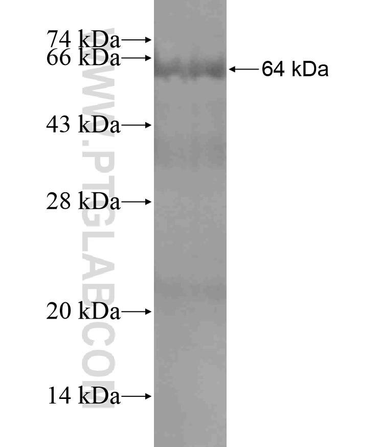 EPRS fusion protein Ag18011 SDS-PAGE