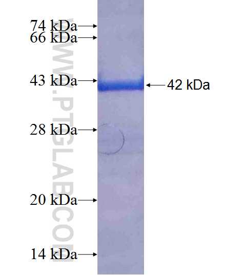 EPRS fusion protein Ag19184 SDS-PAGE