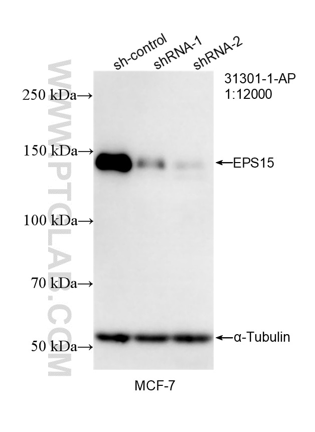 WB result of EPS15 antibody (31301-1-AP; 1:12000; incubated at room temperature for 1.5 hours) with sh-Control and sh-EPS15 transfected MCF-7 cells. Western Blot (WB) analysis of MCF-7 cells using EPS15 Polyclonal antibody (31301-1-AP)