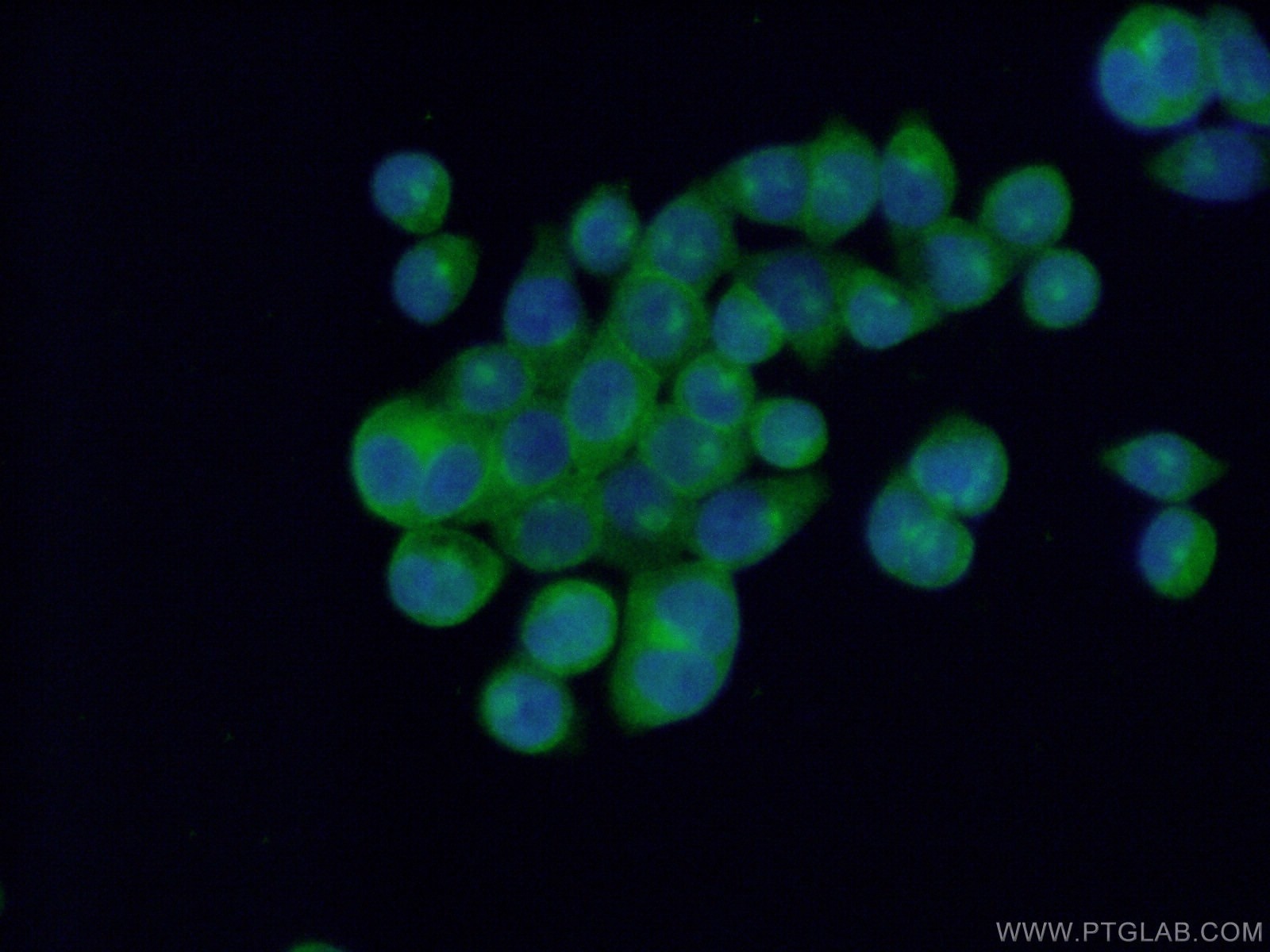Immunofluorescence (IF) / fluorescent staining of BxPC-3 cells using EPS15R Polyclonal antibody (21243-1-AP)
