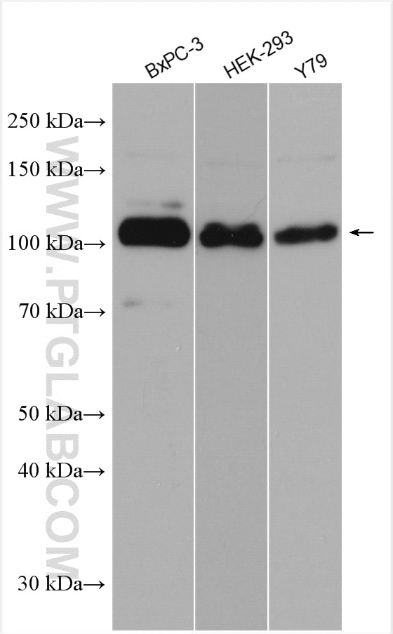 Western Blot (WB) analysis of various lysates using EPS15R Polyclonal antibody (21243-1-AP)