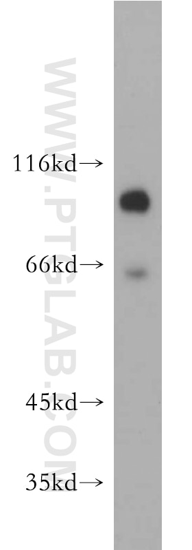 Western Blot (WB) analysis of MCF-7 cells using EPS15R Polyclonal antibody (21243-1-AP)