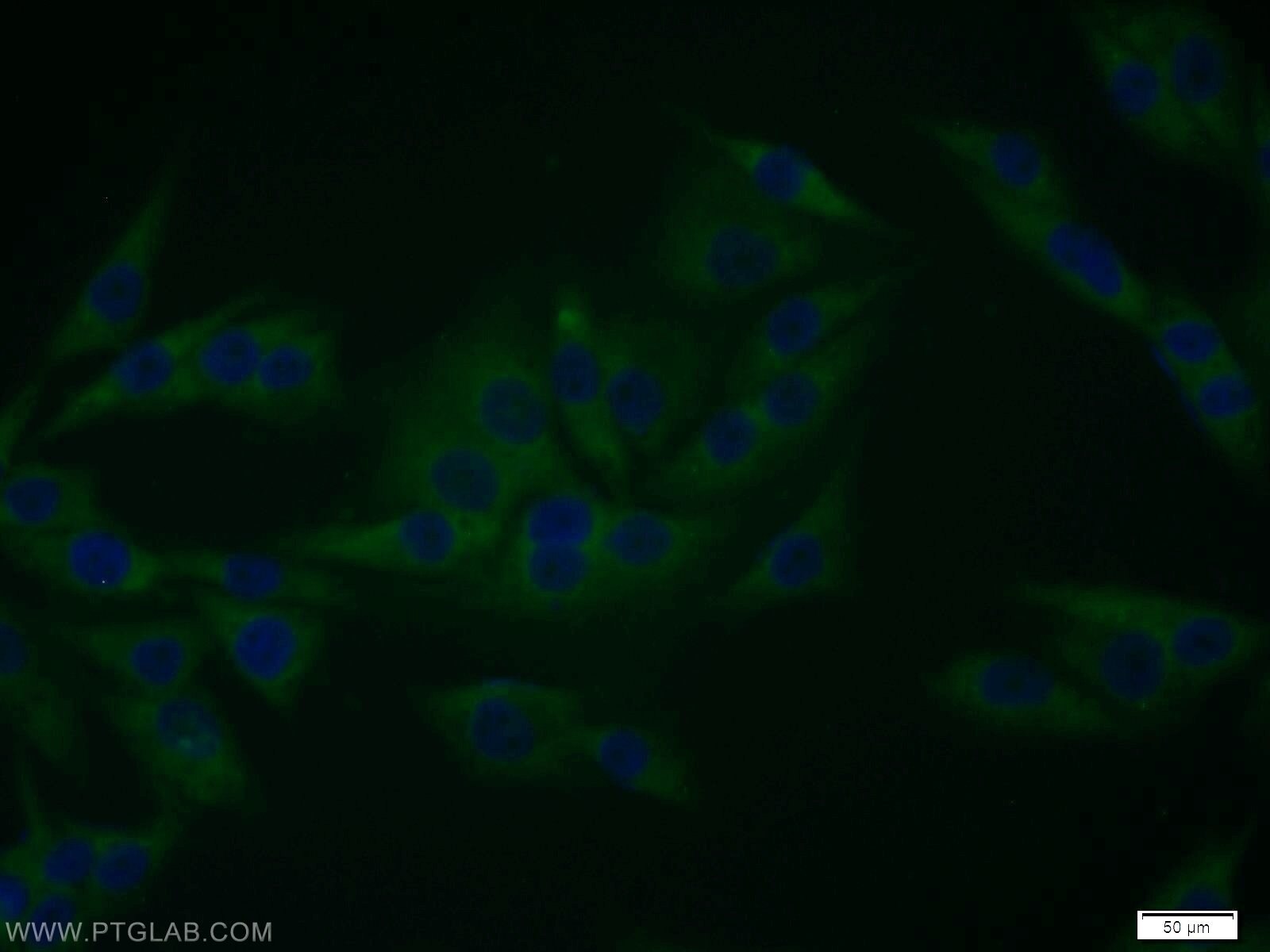 Immunofluorescence (IF) / fluorescent staining of A375 cells using EPS8 Polyclonal antibody (12455-1-AP)