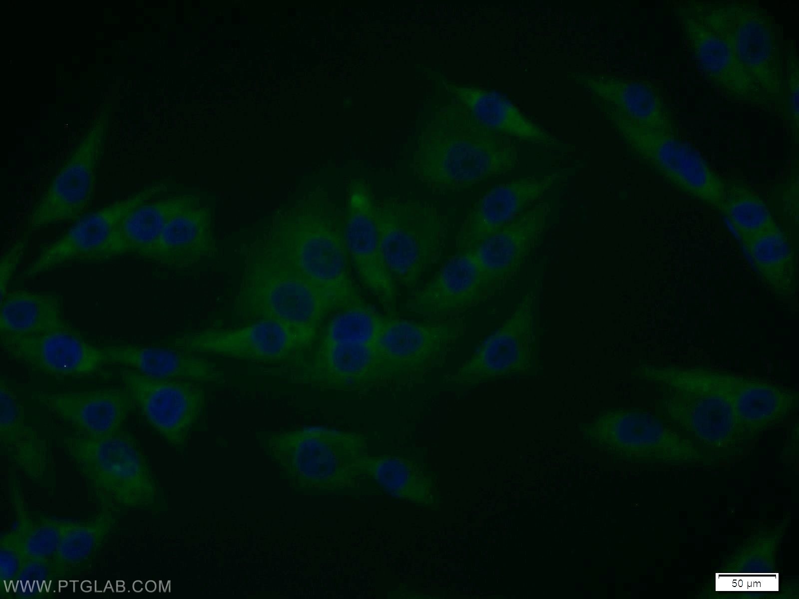 IF Staining of A375 using 12455-1-AP