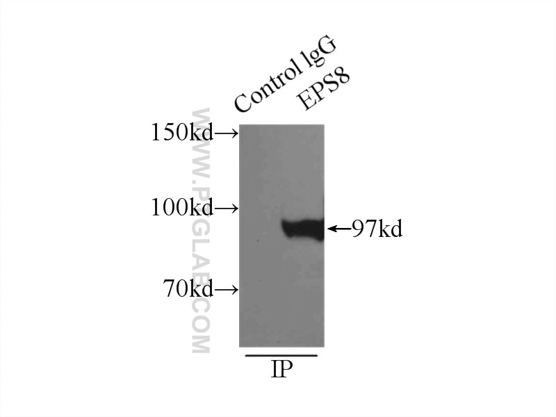 Immunoprecipitation (IP) experiment of HeLa cells using EPS8 Polyclonal antibody (12455-1-AP)