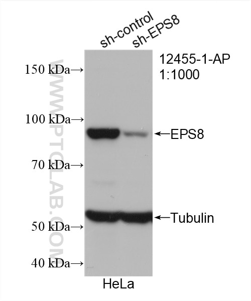 Western Blot (WB) analysis of HeLa cells using EPS8 Polyclonal antibody (12455-1-AP)