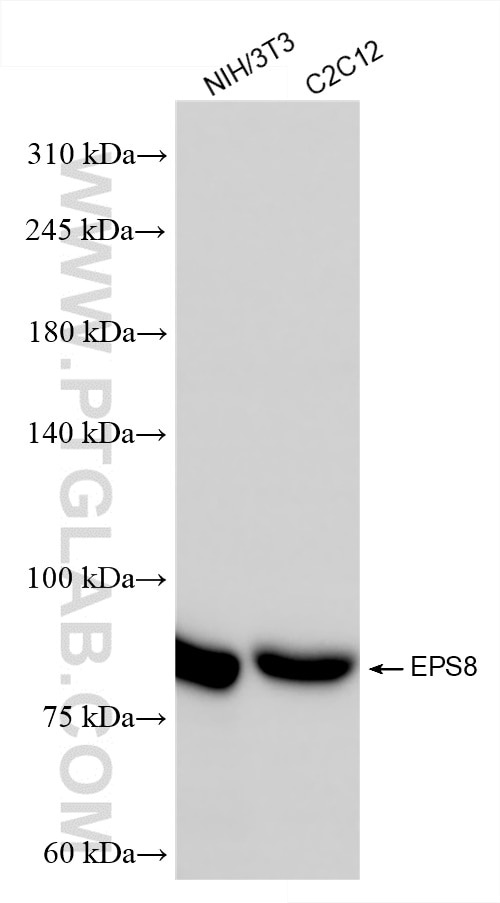Western Blot (WB) analysis of various lysates using EPS8 Recombinant antibody (85184-5-RR)