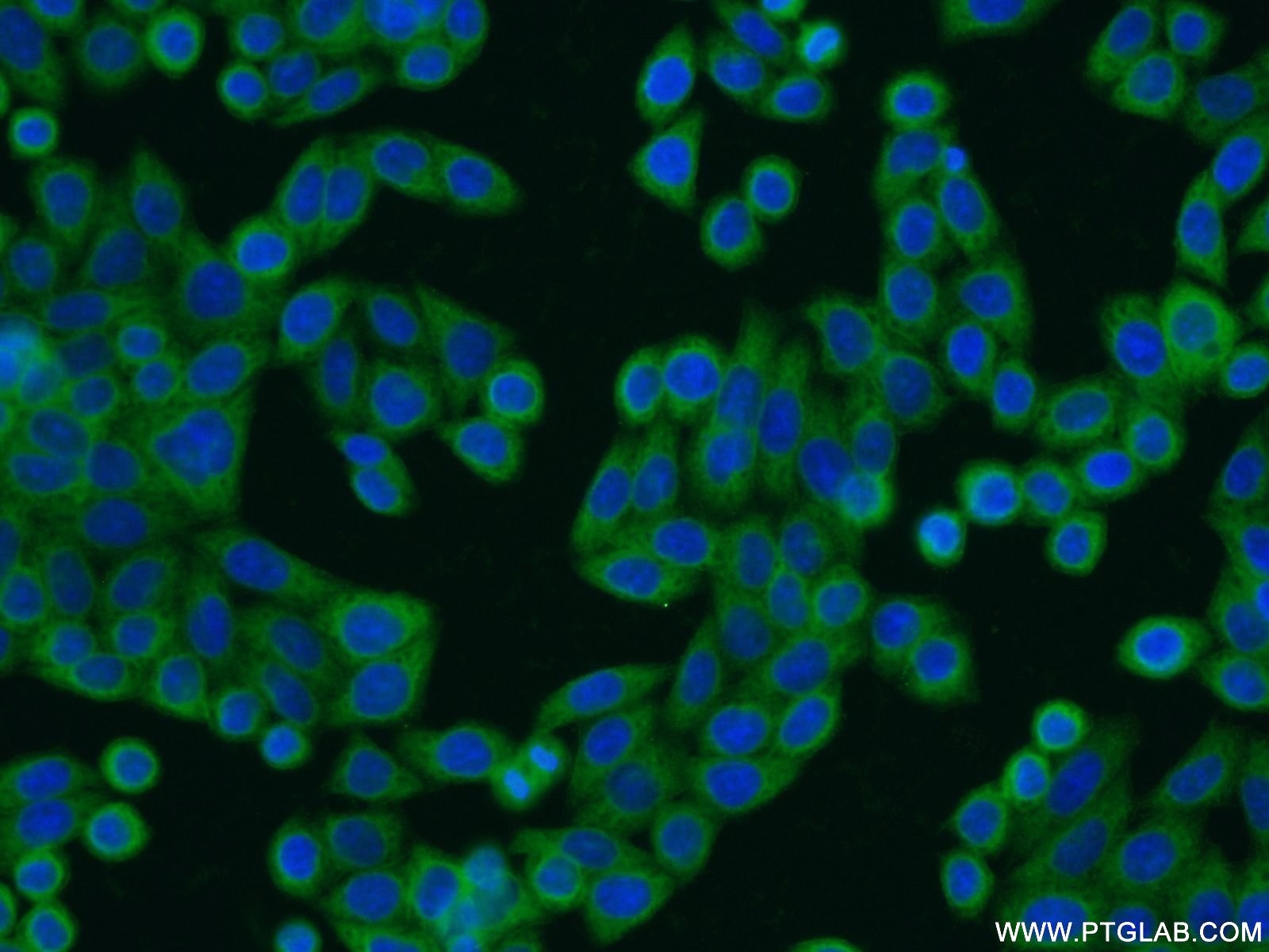 Immunofluorescence (IF) / fluorescent staining of HeLa cells using EPS8L2 Polyclonal antibody (20461-1-AP)
