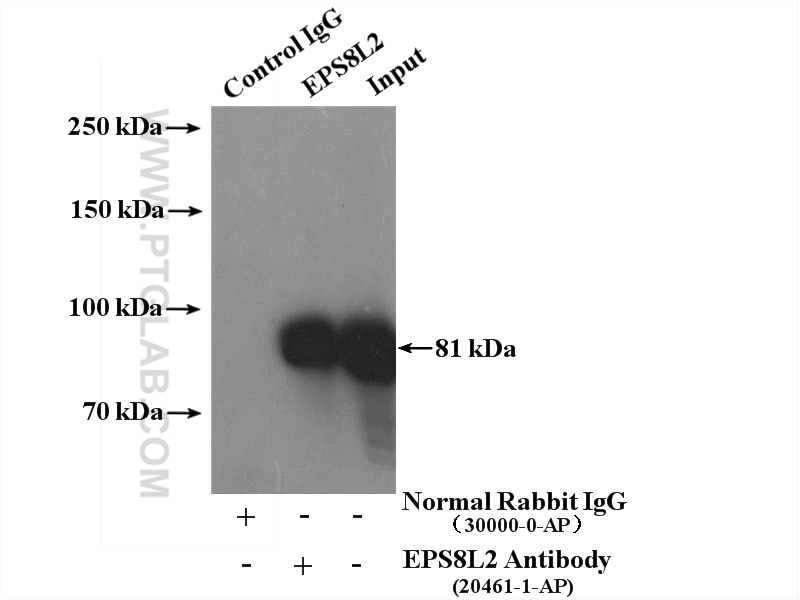 Immunoprecipitation (IP) experiment of HeLa cells using EPS8L2 Polyclonal antibody (20461-1-AP)