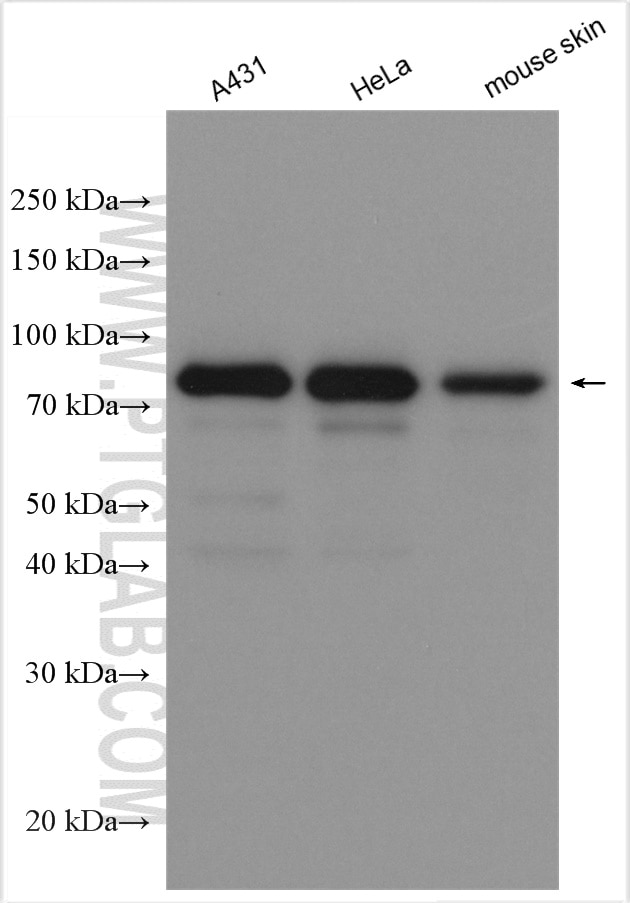 Western Blot (WB) analysis of various lysates using EPS8L2 Polyclonal antibody (20461-1-AP)