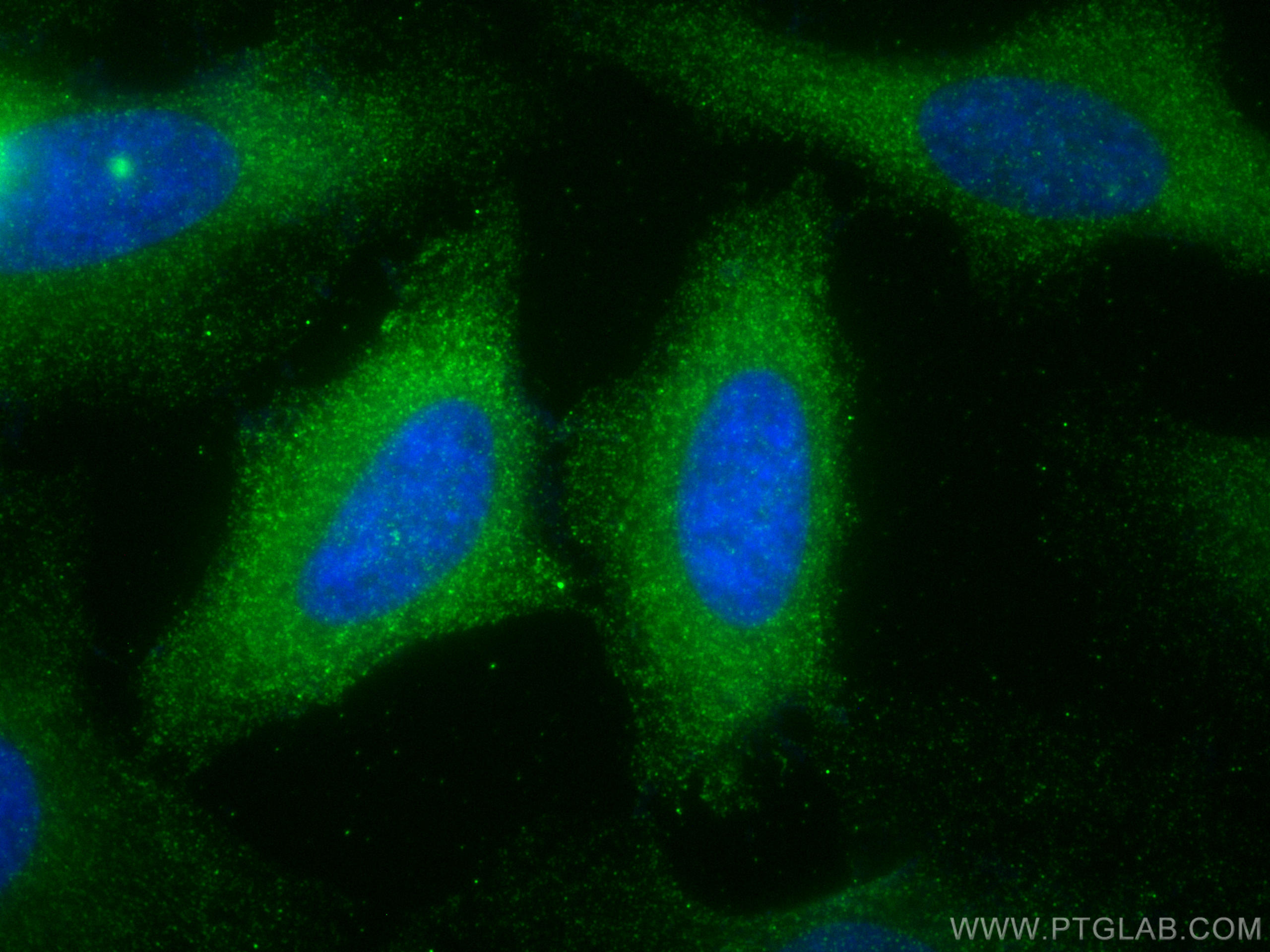 Immunofluorescence (IF) / fluorescent staining of HeLa cells using EPS8L2 Monoclonal antibody (68330-1-Ig)