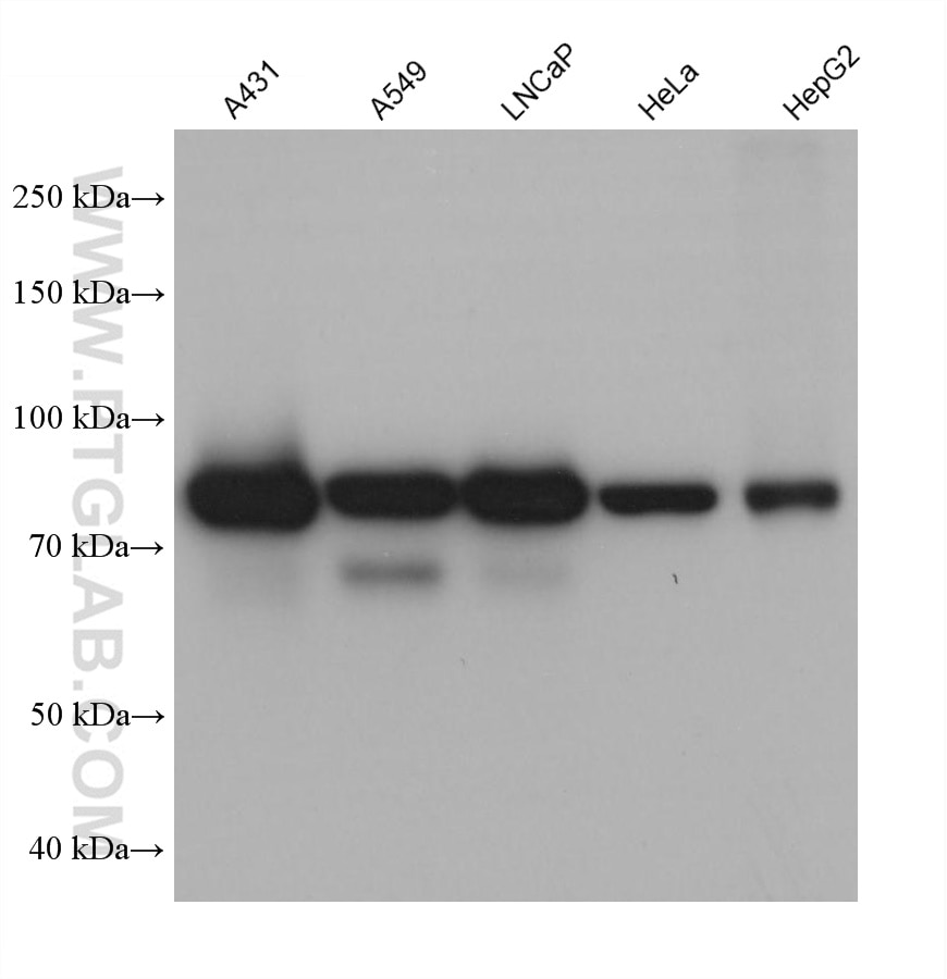 Western Blot (WB) analysis of A431 cells using EPS8L2 Monoclonal antibody (68330-1-Ig)