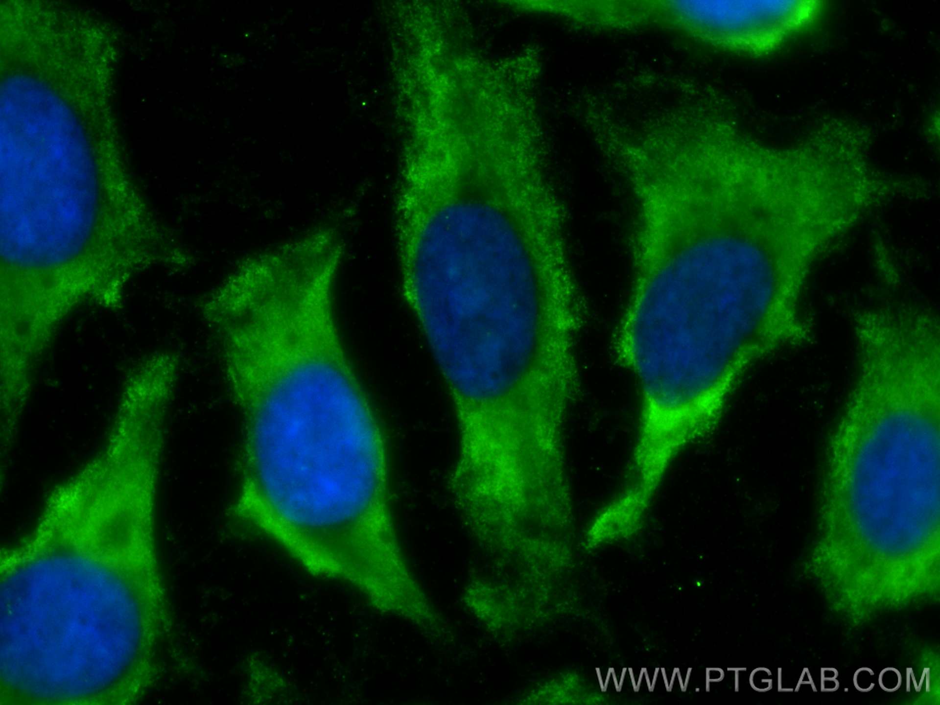 Immunofluorescence (IF) / fluorescent staining of HeLa cells using CoraLite® Plus 488-conjugated EPS8L2 Monoclonal an (CL488-68330)
