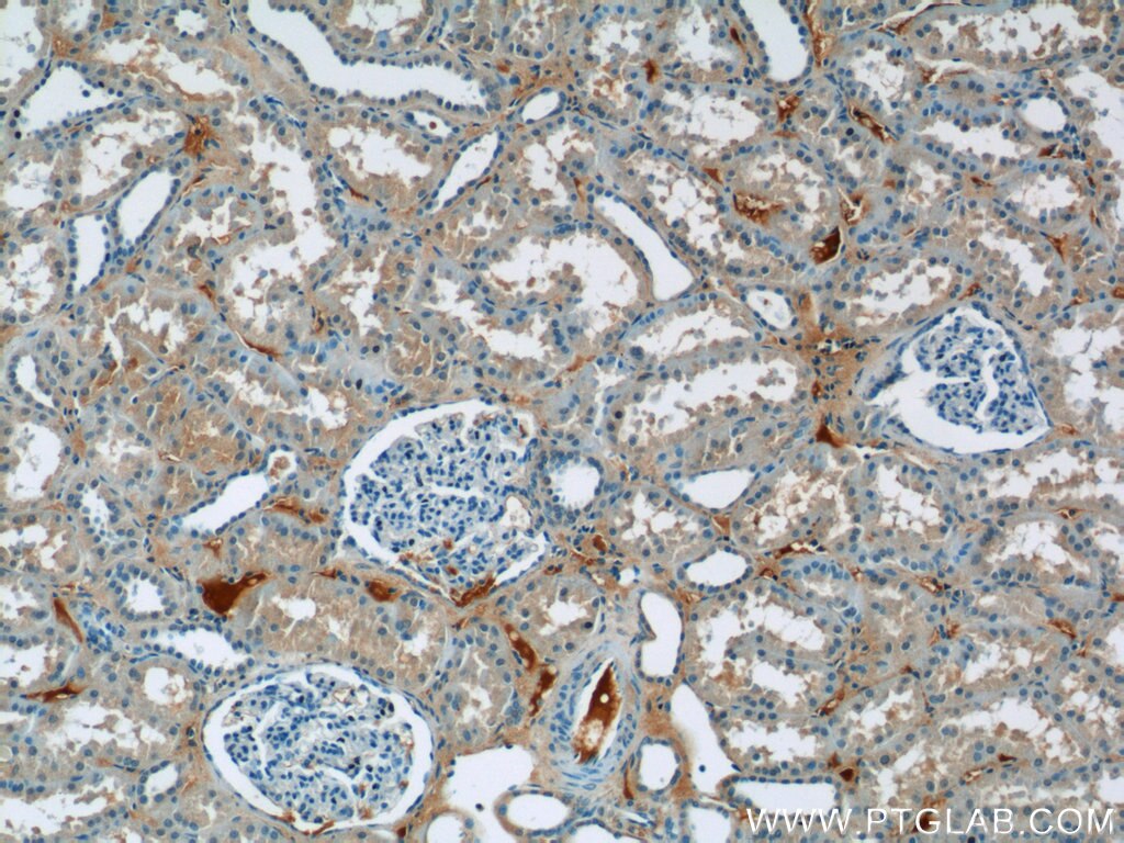 Immunohistochemistry (IHC) staining of human kidney tissue using EPSTI1 Polyclonal antibody (11627-1-AP)