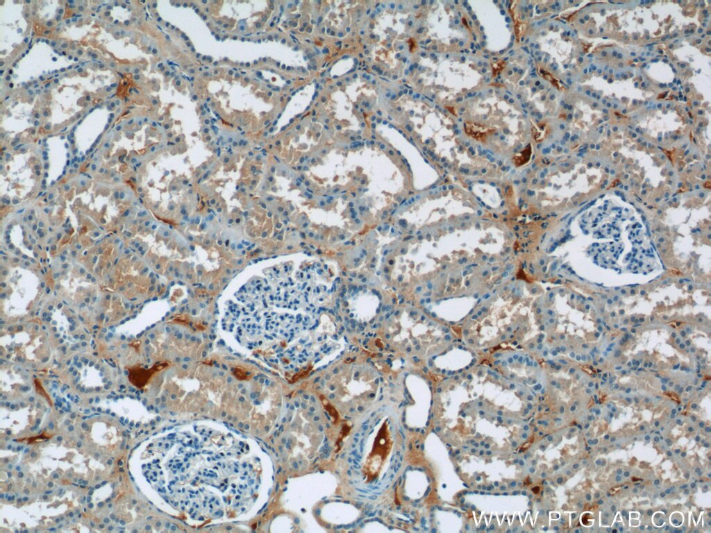 IHC staining of human kidney using 11627-1-AP