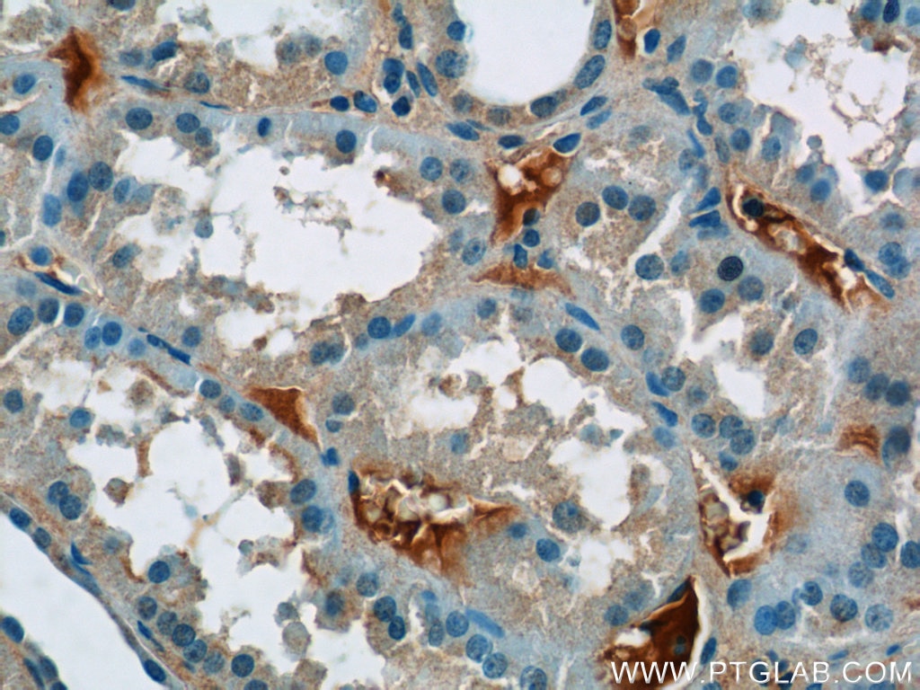 Immunohistochemistry (IHC) staining of human kidney tissue using EPSTI1 Polyclonal antibody (11627-1-AP)