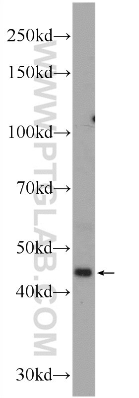 WB analysis of mouse small intestine using 11627-1-AP