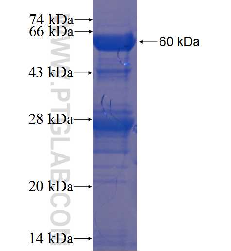 EPSTI1 fusion protein Ag2157 SDS-PAGE