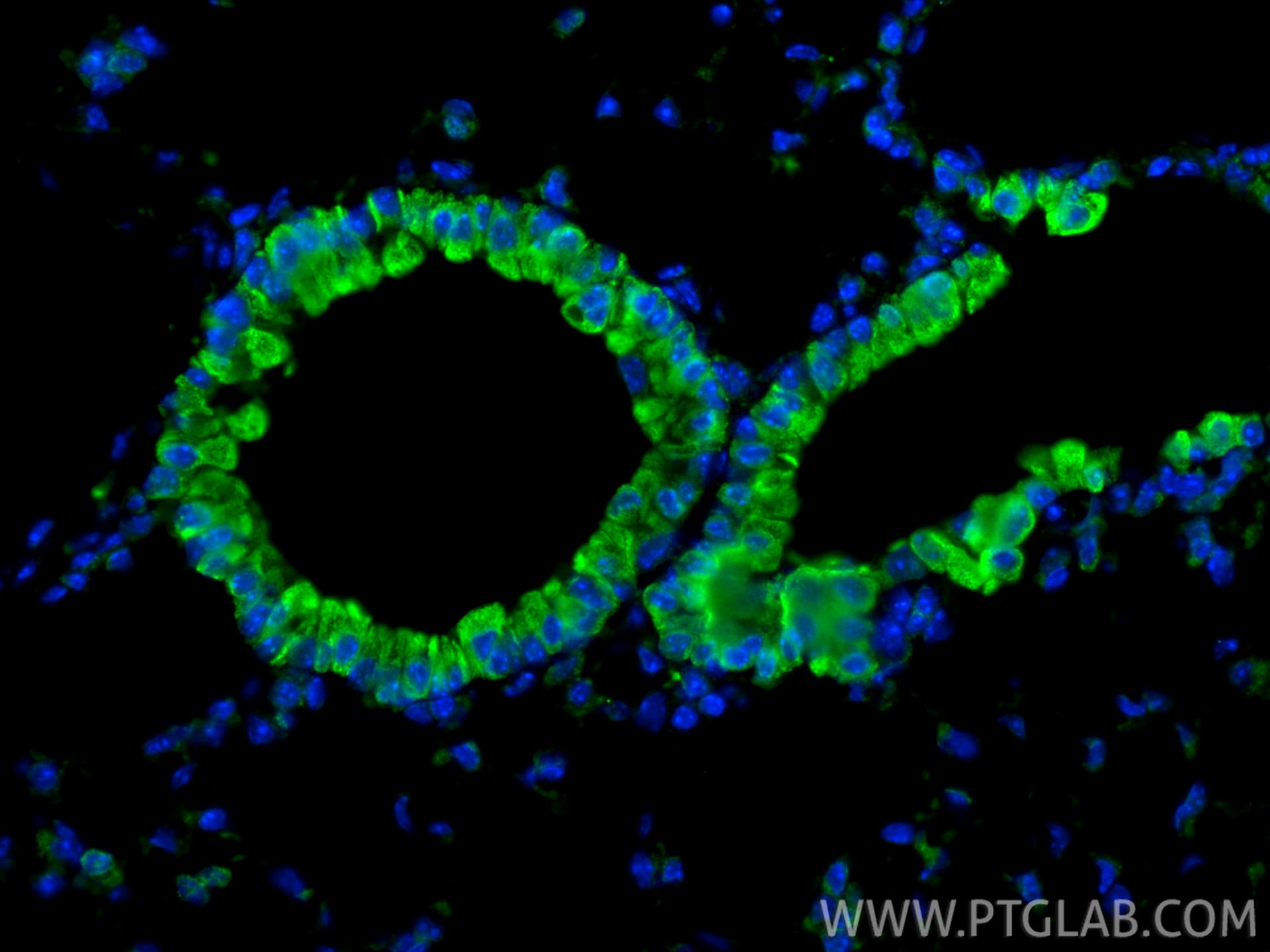 Immunofluorescent analysis of (4% PFA) fixed paraffin-embedded mouse lung tissue using EPX antibody (29755-1-AP) at dilution of 1:200 and CoraLite®488-Conjugated Goat Anti-Rabbit IgG(H+L) (SA00013-2). Heat mediated antigen retrieval with Tris-EDTA buffer (pH 9.0). Immunofluorescence (IF) / fluorescent staining of mouse lung tissue using EPX Polyclonal antibody (29755-1-AP)