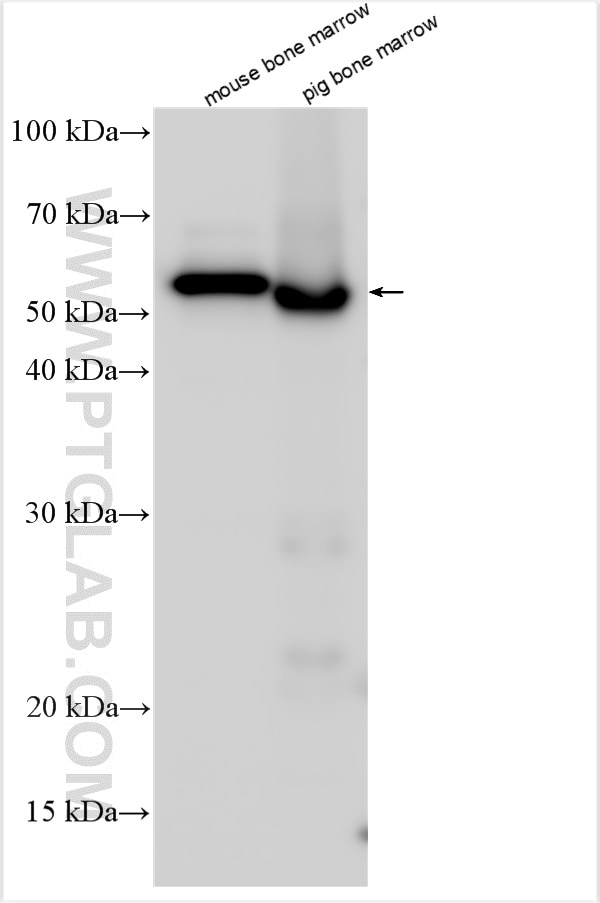 Western Blot (WB) analysis of various lysates using EPX Polyclonal antibody (29755-1-AP)