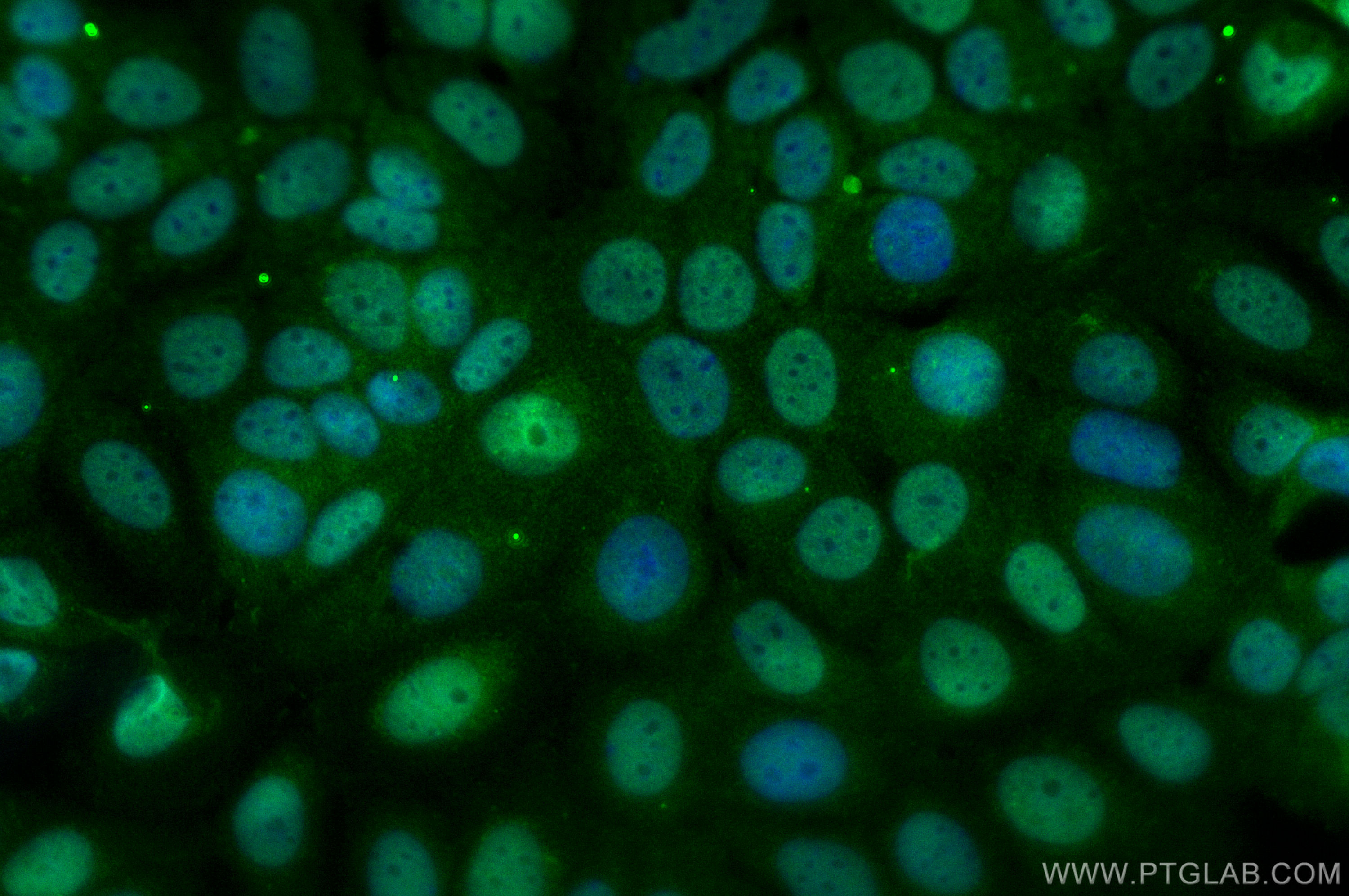 Immunofluorescence (IF) / fluorescent staining of MCF-7 cells using ER Polyclonal antibody (20698-1-AP)