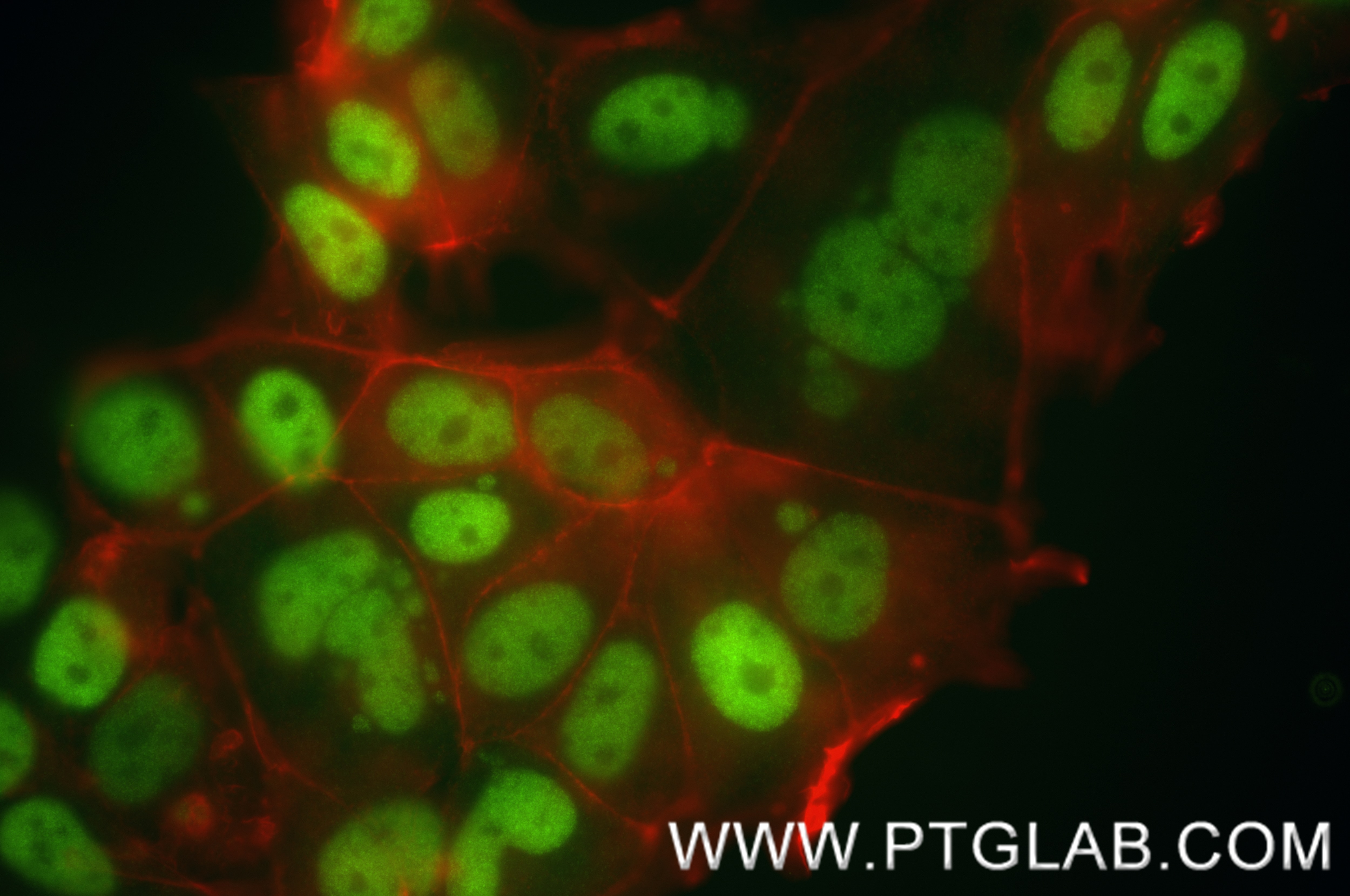 Immunofluorescence (IF) / fluorescent staining of MCF-7 cells using ER Recombinant antibody (84564-4-RR)