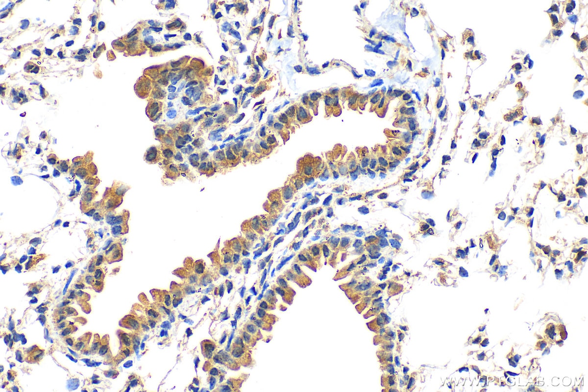 Immunohistochemistry (IHC) staining of mouse lung tissue using AHSP Polyclonal antibody (13643-1-AP)